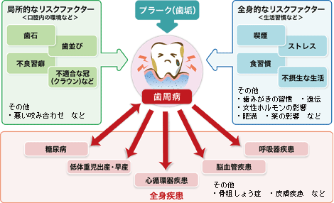 歯周病がもたらす影響